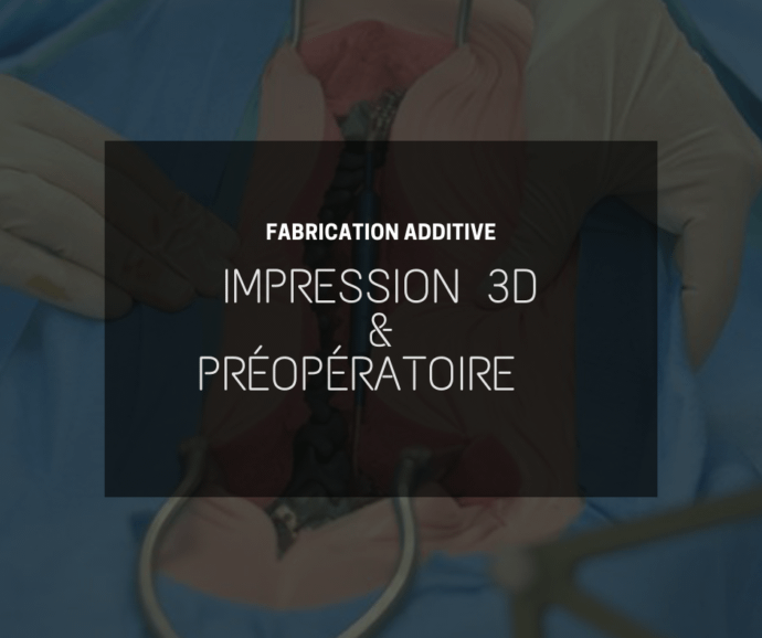 Impression 3D et préopératoire : des solutions pour la santé